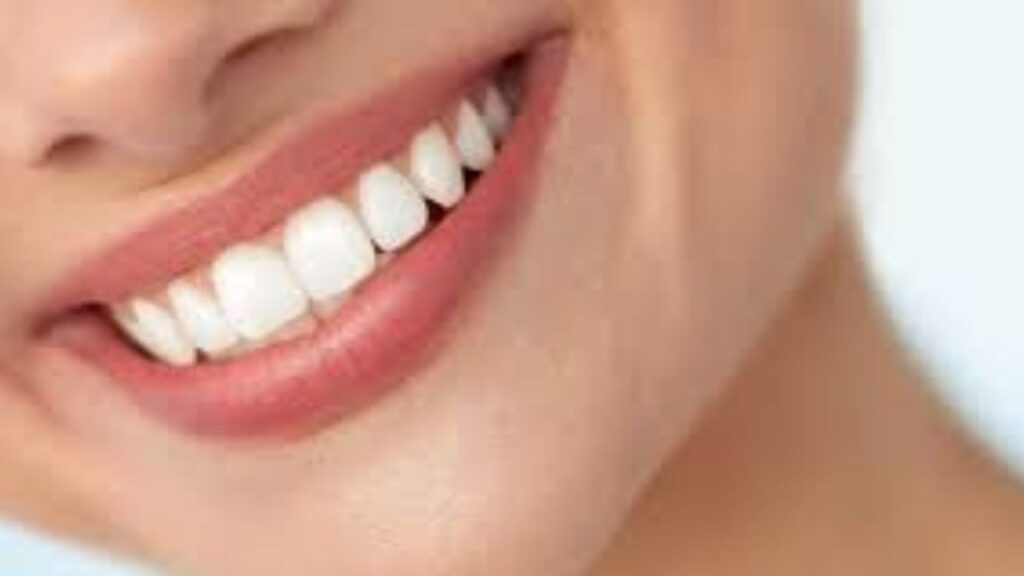 Beautiful Smiles with Veneers in London